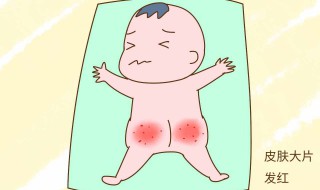 洗屁股怎么能洗干净 日常生活应该如何