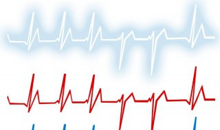58岁心跳多少正常 心跳加快的原因有哪些