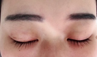 眼睛怎么消肿 眼睛肿怎么消肿