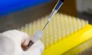 核酸检测多少钱洛阳 洛阳核酸检测的费用