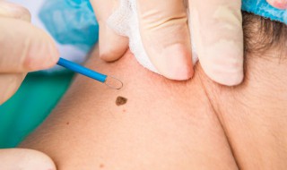 胸下有痣代表什么意思 胸下有痣表示什么