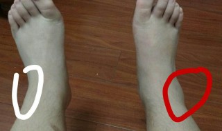 脚肿胀痛是什么原因 不明原因脚肿胀痛?