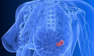 乳腺囊肿要紧吗 乳腺囊肿严不严重？