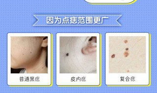 眼皮有痣代表什么 眼皮上有痣什么意思