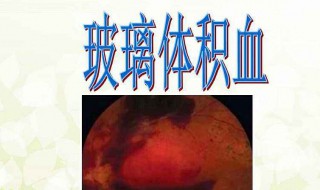 玻璃体积血怎么治疗 玻璃体积血治疗方法