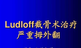 母指外翻怎么治疗 拇外翻治疗方法
