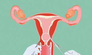 45岁取环后注意什么 过来看看吧