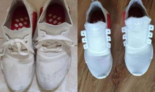 鞋边发黄怎么快速变白 鞋边发黄是什么原因