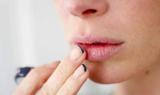 冬季嘴唇干裂脱皮怎么办 应该怎么护理