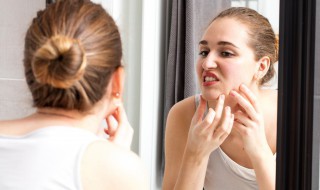 长痘为什么不能喝牛奶 长痘不能喝牛奶吗