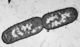 二分裂的具体过程是什么 二分裂的具体过程分享