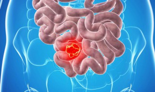 屁是什么气体化学名 屁的化学名