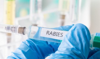 被狗抓了要打疫苗吗 被狗抓伤需要打狂犬疫苗吗