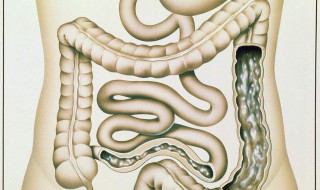 慢性肠道炎有哪些症状 慢性肠道炎的症状