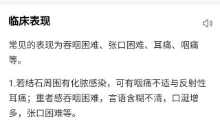 扁桃体结石挂什么科 扁桃体结石要看哪个科