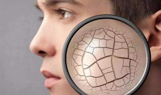 脸部干燥怎么补水 脸部干燥补水方法