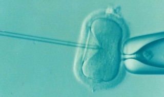 体外受精什么意思 体外受精简单介绍