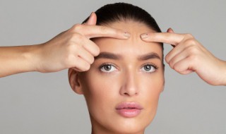 额头上长痘是什么原因 额头上长痘的原因介绍