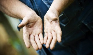 冬天皮肤干燥怎么办 皮肤干燥快试试这些方法