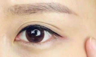 怎样让眼睛快速消肿 让眼睛快速消肿的窍门有哪些