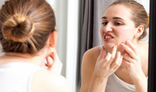 长在脸上的痘痘怎么治 长在脸上的痘痘的治法