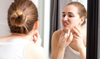 快速有效的祛痘方法 快速祛痘小妙招