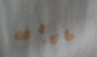 牙膏洗油渍后衣服发白 衣服有污渍怎么办