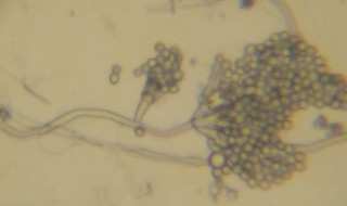 青霉菌的形态结构 青霉菌的形态结构介绍