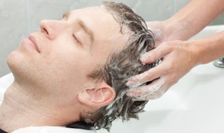 治头皮屑的洗发水 关于治头皮屑的洗发水