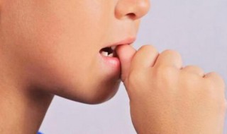孩子爱啃指甲怎么解决 孩子爱啃指甲如何解决