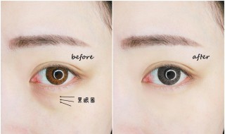 眼袋黑眼圈怎么造成的 眼袋和黑眼圈是形成原因