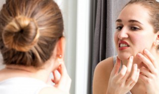 消粉刺痘痘的方法(怎么消粉刺性痘痘)