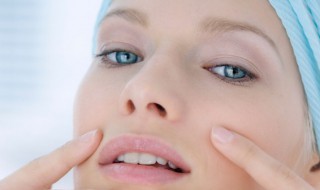 油性皮肤长痘痘怎么办 油性脸长痘痘怎么办