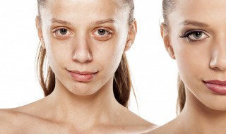 快速美白好方法 怎样美白最快最有效的方法