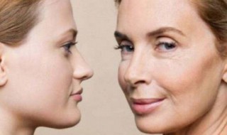 颈纹比较多有什么方法解决 颈纹有什么办法