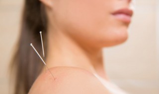 针灸为什么能治病 针灸为啥能治病