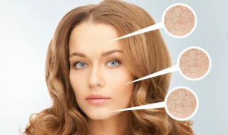 果酸怎么解决毛孔粗大 果酸怎么解决毛孔粗大呢