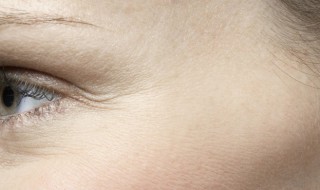 眼纹改善的最好方法(怎样改善眼纹)
