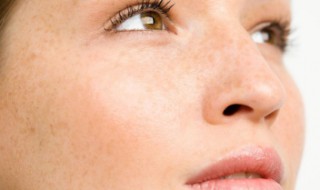 内调淡斑最好的方法是什么 长斑的原因