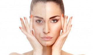 介绍晒后美白的方法 晒后美白的方法分享