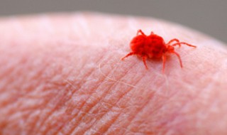 猫蚤咬了怎么处理 人被猫蚤咬了怎么处理