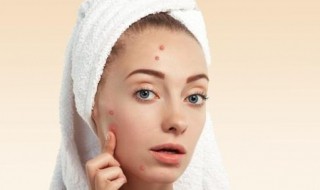 额头上长了很多粉刺如何处理 额头上长了很多粉刺如何处理掉