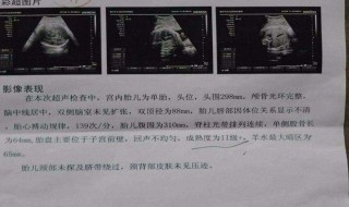 孕早期哪种情况要做B超（怀孕早期做哪种B超）