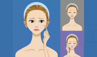 脸上三角区总长痘痘怎么办 脸上三角区总长痘痘怎么办用什么药