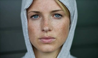 如何改善皮肤暗沉 如何改善皮肤暗沉发黑