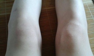 两周岁宝宝走路膝盖是直的吗 两周岁宝宝走路膝盖是直的吗是弯的