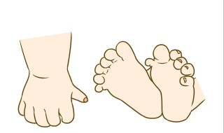 什么是婴儿多指（新生婴儿多指）