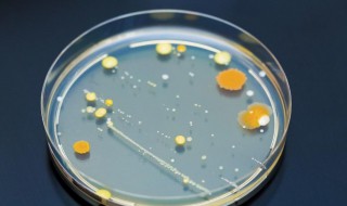 真菌培养方法四个步骤 真菌培养方法四个步骤是什么