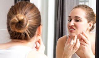 黑色痘印怎样淡化最快 黑色痘印怎样淡化最快方法