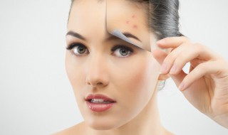 有效去除痘印的小妙招(有效去除痘印的小妙招图片)